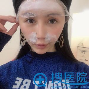注射玻尿酸填充前的敷麻药过程图 注射玻尿酸填充前的敷麻药过程图