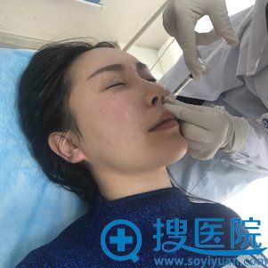 <!--<i data=20240710 data-id=12459></i>-->刘卓注射玻尿酸过程 <!--<i data=20240710 data-id=12459></i>-->刘卓注射玻尿酸过程