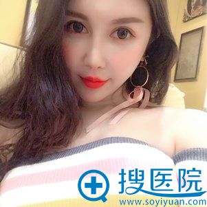 <!--<i data=20240710 data-id=12459></i>-->玻尿酸填充鼻唇沟案例 <!--<i data=20240710 data-id=12459></i>-->玻尿酸填充鼻唇沟案例