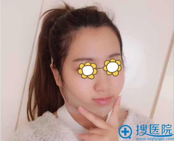 膨体隆下巴术后3天照片 膨体隆下巴术后3天照片