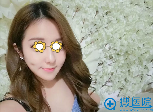 太原花妍膨体隆下巴+吸脂术后效果 太原花妍膨体隆下巴+吸脂术后效果
