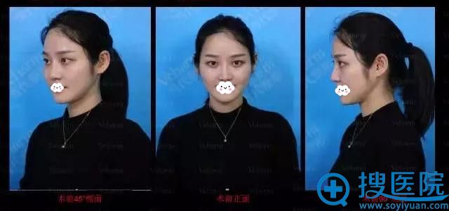 ���쵱��˫��Ƥ��ǰ