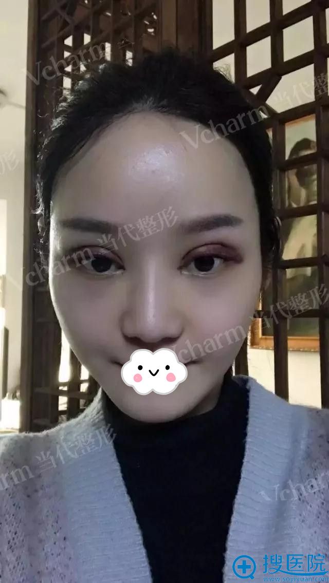 ���쵱��˫��Ƥ����2��