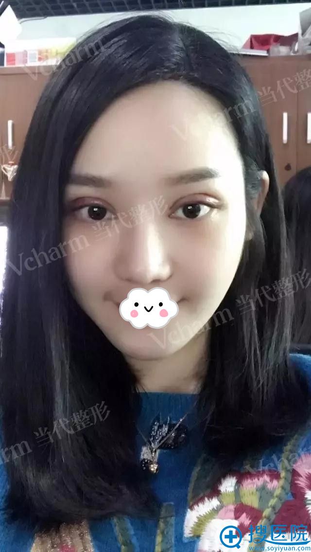��������˫��Ƥ����5��Ч��