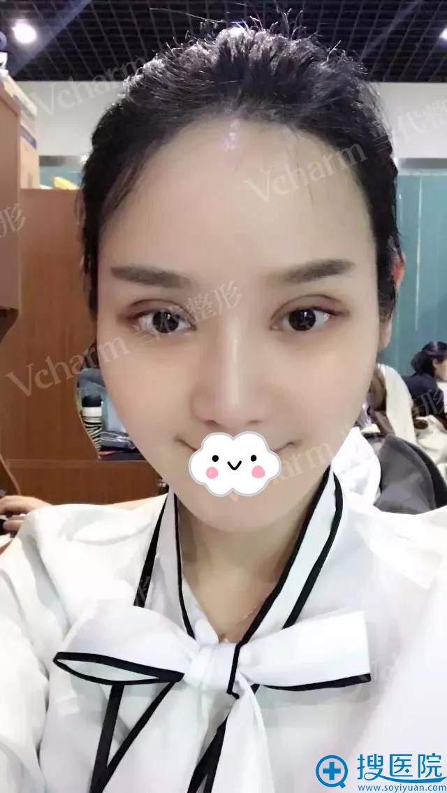 ����˫��Ƥ����8��Ч��