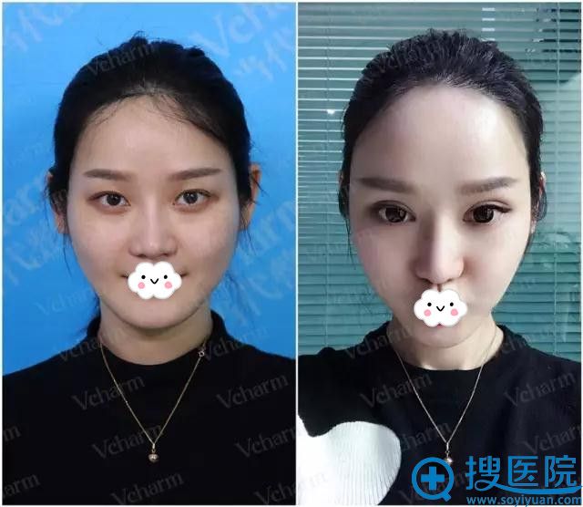 ���쵱��˫��Ƥ��ǰ��������