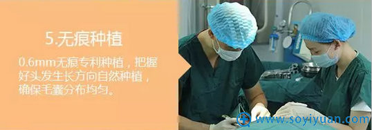 使用技术进行无痕植发 使用技术进行无痕植发