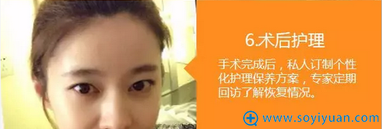 郑州华领发际线种植效果 郑州华领发际线种植效果