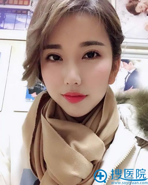 芜湖伊莱美<!--<i data=20240710 data-id=17317></i>-->鼻综合案例图 芜湖伊莱美<!--<i data=20240710 data-id=17317></i>-->鼻综合案例图