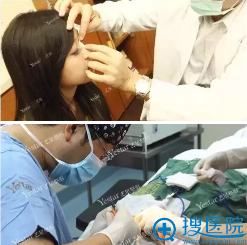西安艺星隆鼻术前面诊及手术过程 西安艺星隆鼻术前面诊及手术过程