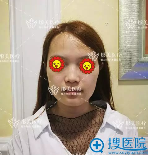 �����ۺ���������ǰ����������Ƭ