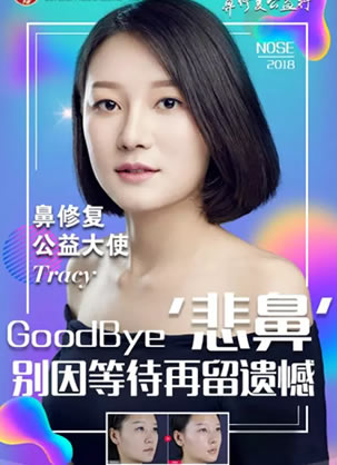 曲靖吴氏嘉美整形医院2018鼻修复公益大使案例效果集体亮相
