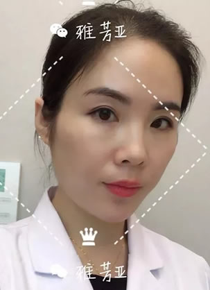 �����ŷ�����С������ҽ����������CGF�沿�ۺϿ�˥��������