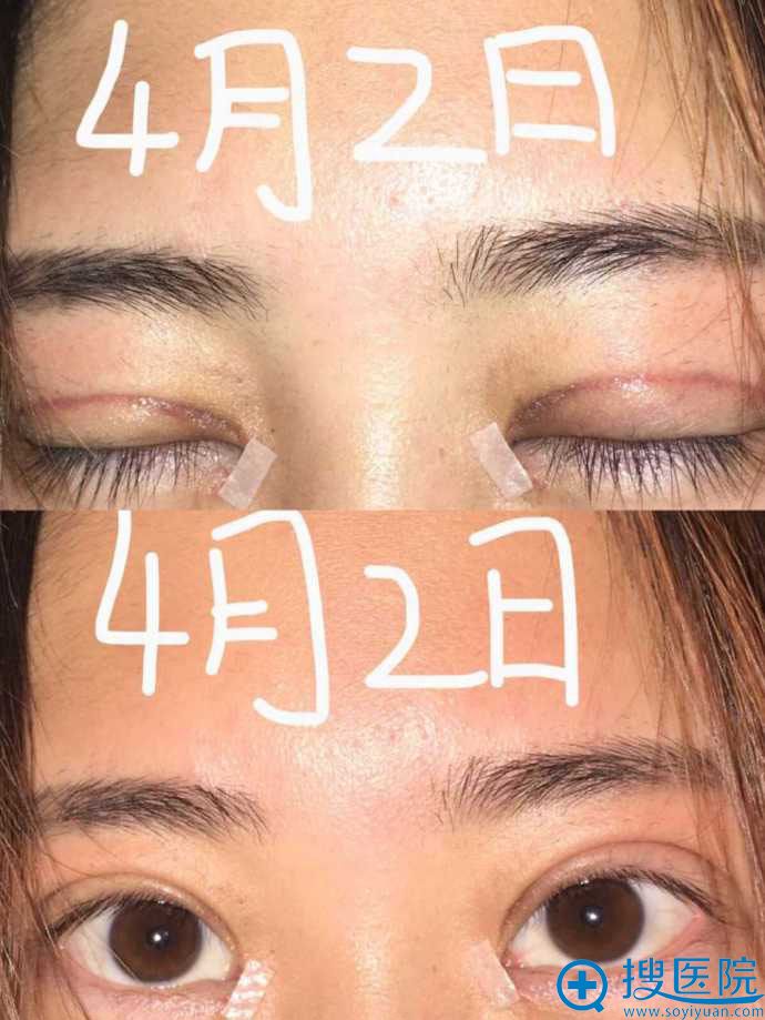 ������������˫��Ƥ����1����Ч��
