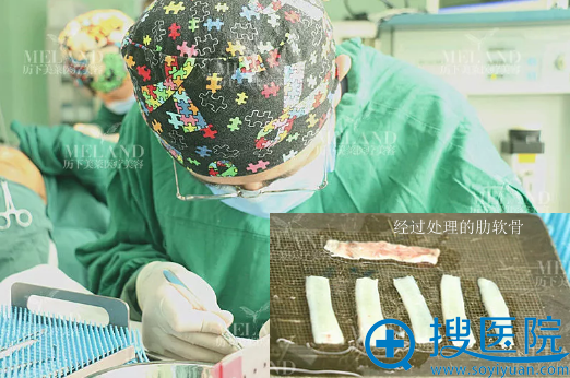 韩旭院长术中对取除的肋软骨进行处理 韩旭院长术中对取除的肋软骨进行处理
