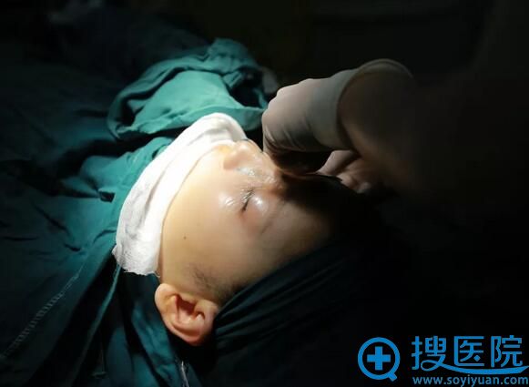 重庆时光整形医院隆鼻术 重庆时光整形医院隆鼻术