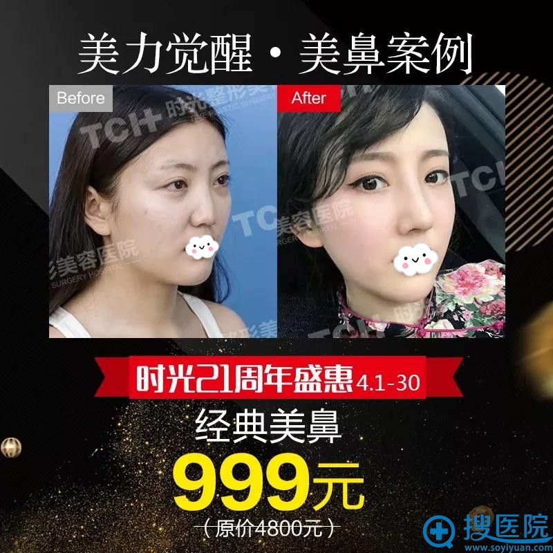 重庆时光经典美鼻999元起 重庆时光经典美鼻999元起