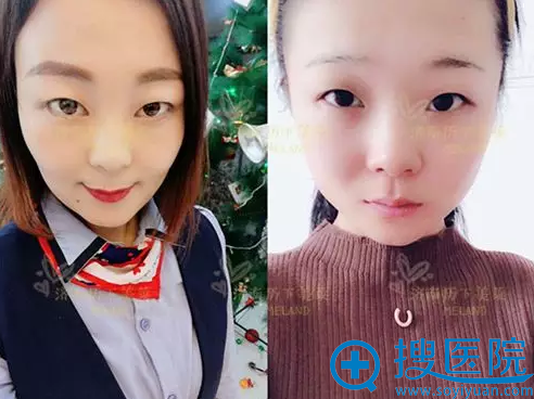 ����90����û��Ҽ������������������п�˫��Ƥ����������