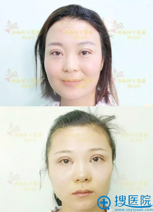 �Һͽ�������˫��Ƥ�ļ���Ч��ͼ