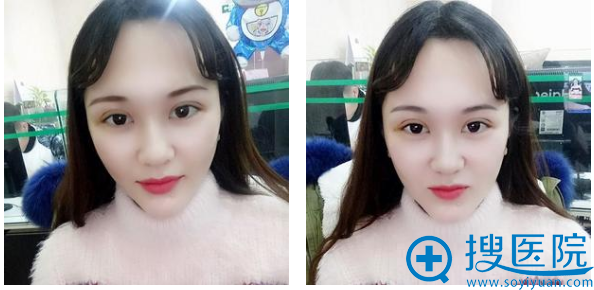 �Ҽ��Ϻ��ϴԹ��Ը�˫��Ƥ10����