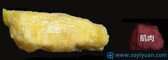 在深圳脂减肥塑形去哪比较好?看看贝漾美天的真实案例再决定