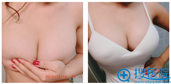 �ַ���¡�ذ�������һ����Ч��ͼ