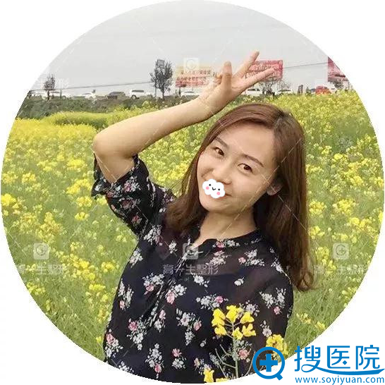玻尿酸一般多少钱?西安高一生打玻尿酸贵不贵,案例价格了解