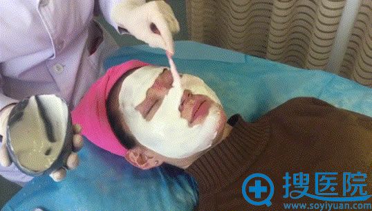 果酸祛痘手术过程之敷面膜 果酸祛痘手术过程之敷面膜
