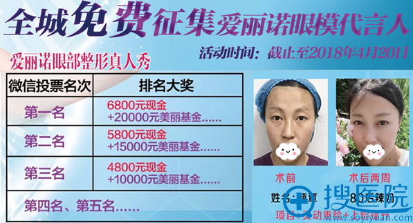 西昌爱丽诺整形美容医院招募眼模代言人 西昌爱丽诺整形美容医院招募眼模代言人