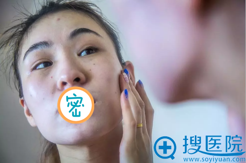 在福州台江做了自体脂肪填充面部 连老公都被她萌化了