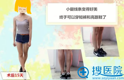注射后15天效果 注射后15天效果