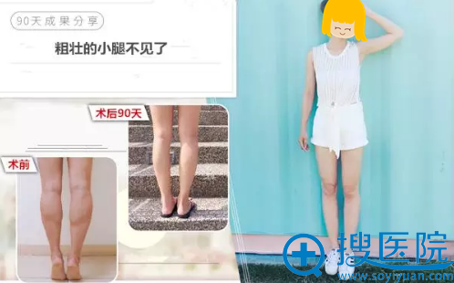 90天国足小腿变芊芊美腿 90天国足小腿变芊芊美腿