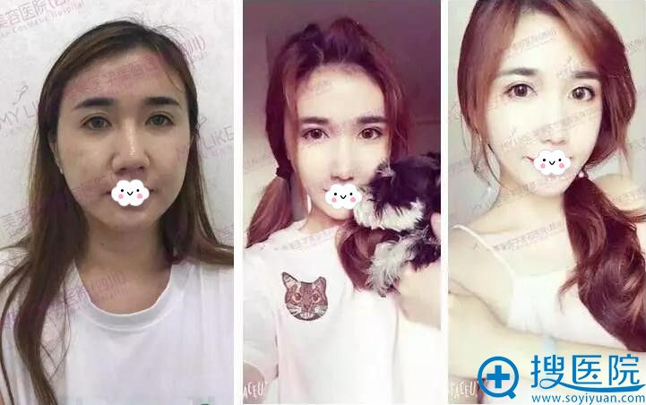 美莱艺术面雕. 立体精塑案例对比 美莱艺术面雕. 立体精塑案例对比
