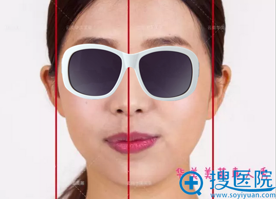 脸部不对称可能是牙齿畸形导致 脸部不对称可能是牙齿畸形导致
