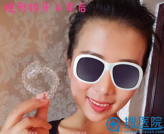 佩戴隐适美矫正牙套半年后效果 佩戴隐适美矫正牙套半年后效果