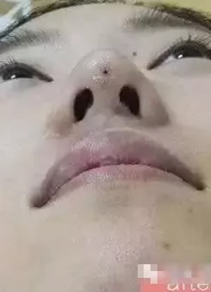 �����ߵ�����������˽��������� �������������ߵ�¡�ǲ���ͼ