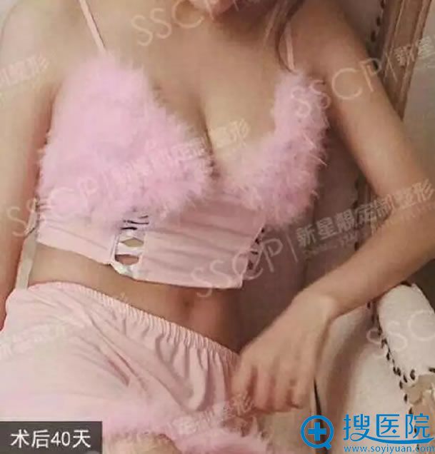 ����������֬����ֲ¡��40��Ч��