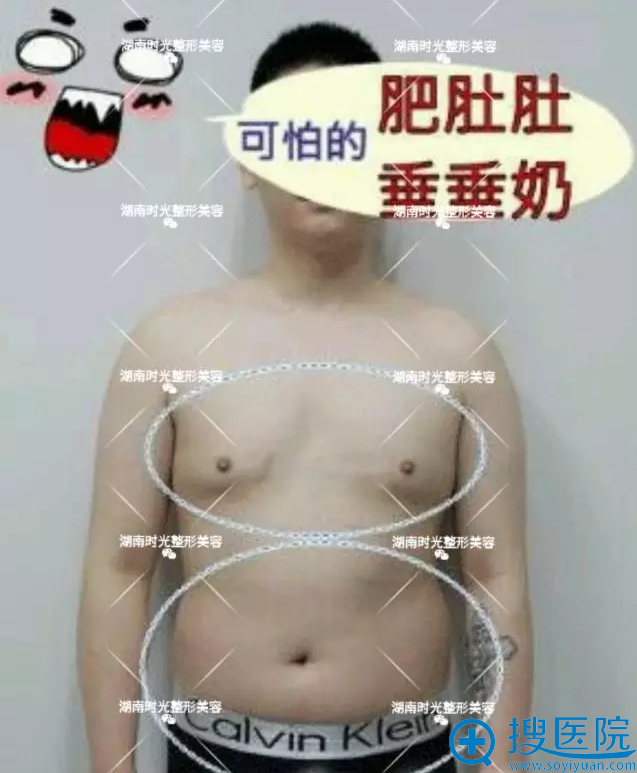 长沙时光整形推出吸脂术减肥将你的胳膊腰腹大腿逆袭骨感女王
