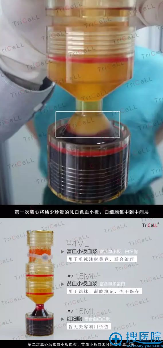 TriCeLL��Ѫ��ϸ����ȡ����