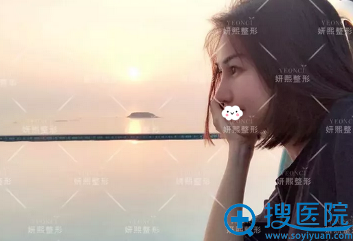 做了鼻综合,随手拍都很漂亮 做了鼻综合,随手拍都很漂亮