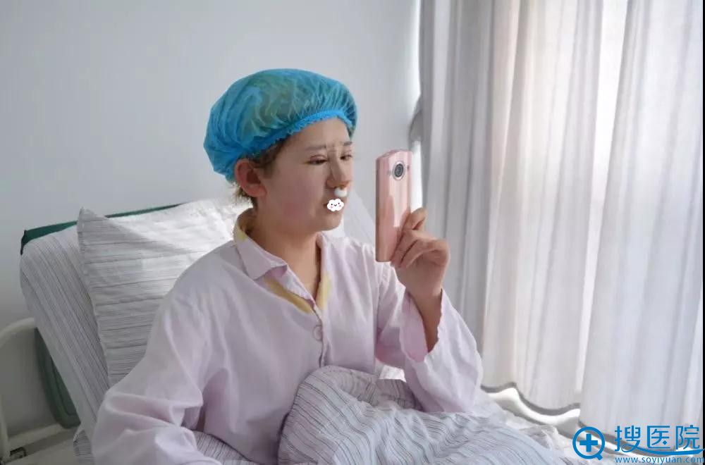 江苏施尔美双眼皮+隆鼻术后3天效果 江苏施尔美双眼皮+隆鼻术后3天效果