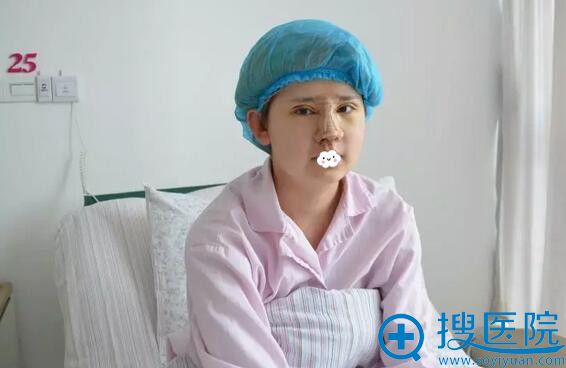 江苏施尔美孙欣双眼皮+隆鼻术后4天案例 江苏施尔美孙欣双眼皮+隆鼻术后4天案例