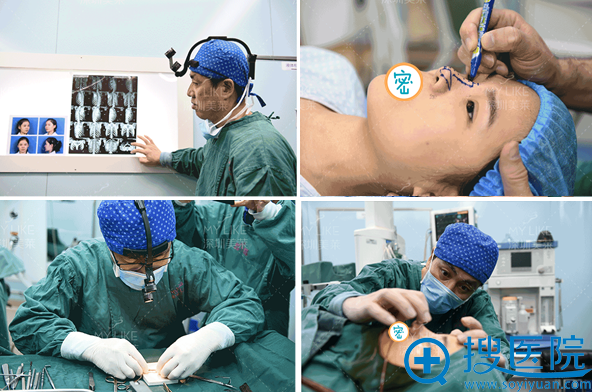 梁晓健肋软骨鼻综合手术全程 梁晓健肋软骨鼻综合手术全程