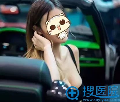 在福康做假体隆胸2个月工作照片 在福康做假体隆胸2个月工作照片