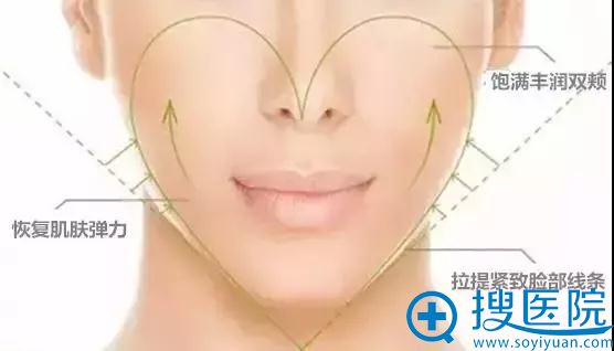 到襄阳维多利亚做自体脂肪面部面部填充后将价格与适应人群公布