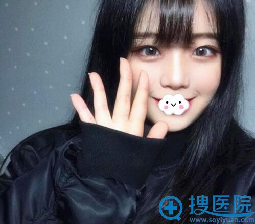 在江苏南京施尔美做玻尿酸填充卧蚕术后5天 在江苏南京施尔美做玻尿酸填充卧蚕术后5天