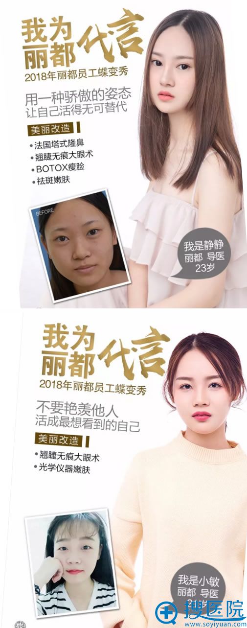 泰州丽都翘睫无痕大眼术员工案例 泰州丽都翘睫无痕大眼术员工案例