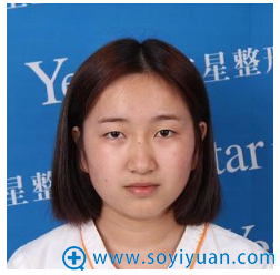 邀请大家一起见证杭州艺星雷中元给我做双眼皮眼综合的案例效果