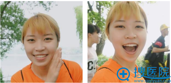 瞧好了 这就是我刚找杭州艺星雷中元做的水滴鼻子案例效果图