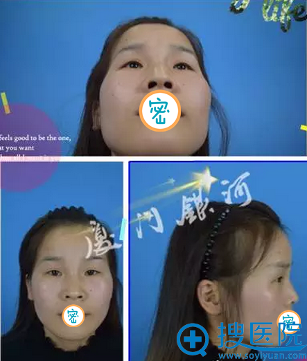 ����լŮ�������ռǣ��������Ӳ��������֬������沿�����ɱ�